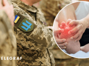 Ілюстрація