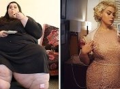 Невероятные снимки людей, которым удалось похудеть до неузнаваемости (Фото) 