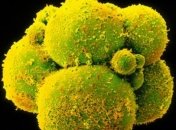 Впервые ученые провели генетическую модификацию эмбриона человека