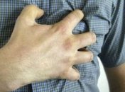 Названо попереджувальні знаки серцевого нападу