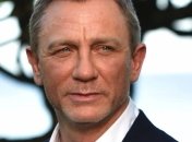 Звезду бондианы прооперируют: во время съемок актер получил трамву ноги