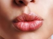 Почему появляется герпес?