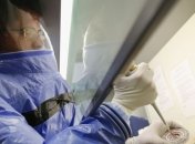 Найден препарат эффективный против Эболы 