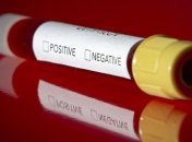 У Німеччині виявили 4764 нових випадки коронавірусу