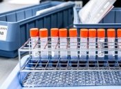 У Запорізькій області 15 осіб госпіталізовано з підозрою на коронавірус