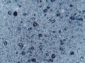 В Европе могут запретить использование микропластика