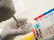 Вакцину против Эболы успешно испытали на макаках  