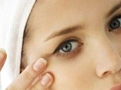 О каких недугах кричат нам темные круги под глазами