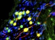 Ученые создали легкое из стволовых клеток