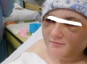 В Херсоне парень сильно избил бывшую девушку