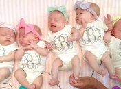 В Одессе женщина родила пятерню