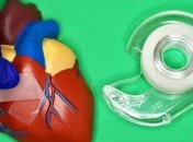 Вчені розробили скотч для склеювання внутрішніх органів людини