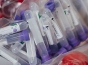 Україна у списку країн з високими темпами поширення COVID-19