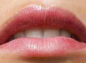 Что делать, если потрескались уголки губ?