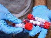 ВОЗ о коронавирусе: Если ситуация "выглядит благополучно", это не значит, что она на самом деле благополучна