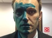 Навальный заявил, что может ослепнуть на один глаз из-за зеленки