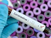 В Минздраве подчеркнули важность проведения ПЦР-тестирования на COVID-19