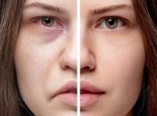 Какие признаки проблем со здоровьем чаще всего "написаны" на лице