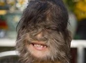 Девочка-волк попала в Книгу рекордов Гиннесса