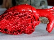 14 новых генетических вариаций, влияющих на работу сердца