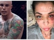 Артур Кулинский избил свою девушку