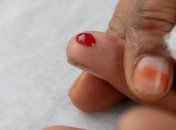 Безопасно ли сдавать кровь?