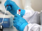 Вакцину AstraZeneca впервые протестируют на детях