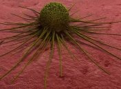 Ученые рассказали, почему у грузчиков чаще всего диагностируют рак