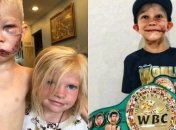 Новую весовую категорию в боксе назовут в честь мальчика, спасшего свою сестру от собаки