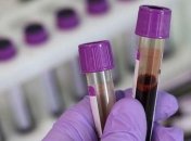 За добу в Україні підтвердили 492 випадки коронавірусу