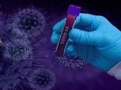 У листопаді будуть такі піки, що всі прозріють: інфекціоніст озвучила прогноз по пандемії коронавірусу в Україні