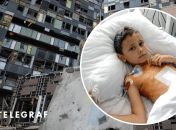 Егор имел отек головного мозга