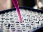 МОЗ за добу зафіксувало 29 нових випадків коронавірусу