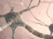 Ученые предположили, что болезнь Паркинсона появляется в двух различных органах