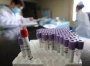 Проверят все детские кухни и пищеблоки