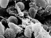 Ученые проследили пути миграции чумы в Европе каменного века