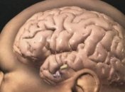 Учеными доказано, что мозг способен принимать добровольные решения