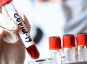 В Україну сьогодні прибуде партія тестів на визначення коронавірусу