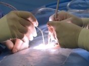 В Австрии мужчине ампутировали не ту ногу: ошибку заметили только спустя два дня