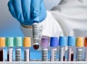 У чернігівській школі зафіксували 13 випадків гепатиту