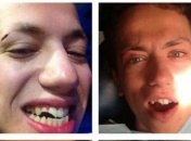 Скандальный ведущий "Дурнев+1" Алексей Дурнев получил по зубам