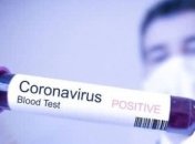 Первый случай коронавируса выявлен в Черниговской области