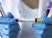 Украинские ученые рассказали о прорыве в лечении коронавируса