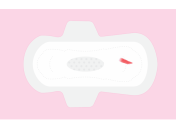 Имплантационное кровотечение: признаки и как действовать