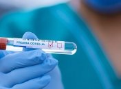 COVID-19 на Херсонщине: число случаев снижается