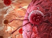 Компьютерный алгоритм поможет ученым обнаружить опасные раковые клетки