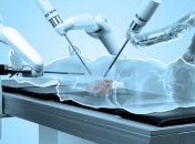 Google и Johnson & Johnson будут разрабатывать роботов-хирургов