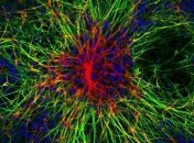 Ученые рассказали, что делает человеческий интеллект уникальным