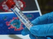 На Київщині підтвердили 1261 випадок Covid-19