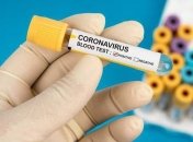 У Житомирі зафіксували ще один випадок коронавірусу